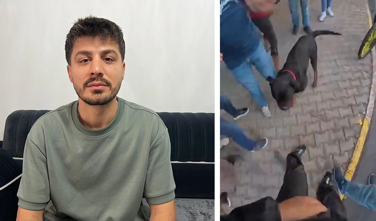 Köpek dehşetinin mağduru motokurye o anları anlattı: "Köpek kafasını çırpabilseydi etimi koparabilirdi"